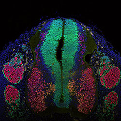 Gene expression in the human embryonic brain